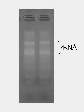 RNA-F泳動